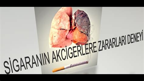 Sigara Bırakma Yöntemleri ve Sigaranın Zararları: Akciğer Sağlığını Koruma Stratejileri